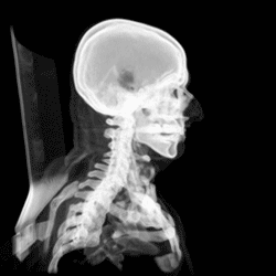CT-Scan eines menschlichen Schädels 