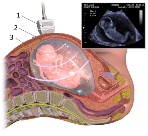 Ultraschalluntersuchung eines Fötus 