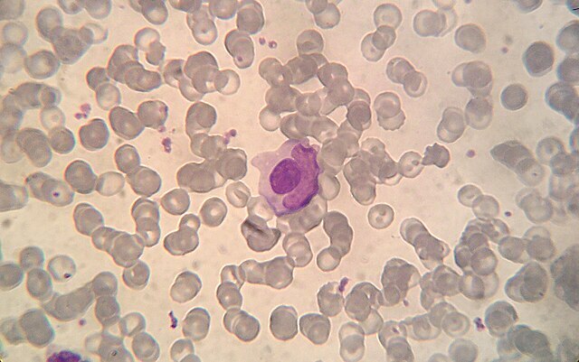 Makrophage stülpt sich über einen Lymphozyten 