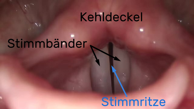 Blick in den Kehlkopf: Links und rechts von der Stimmritze (Spalt) befinden sich die Stimmbänder 