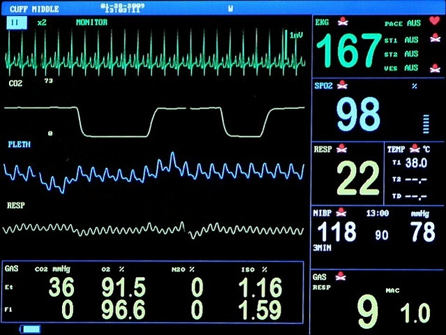 Narkosemonitoring während einer Operation 