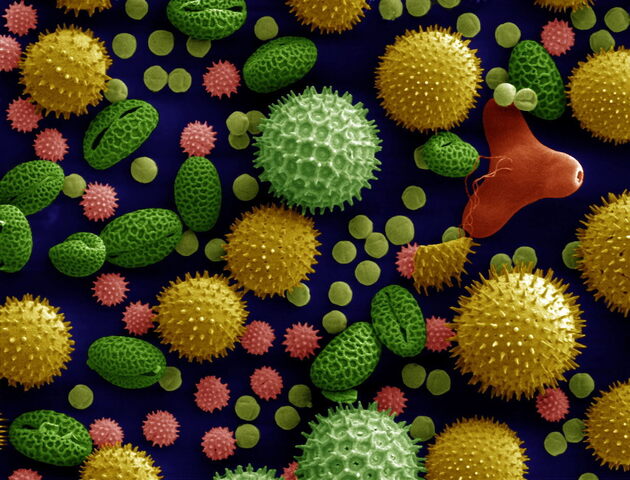Pollen aufgenommen mit einem Elektronenmikroskop (links) und eingefärbt (rechts) 