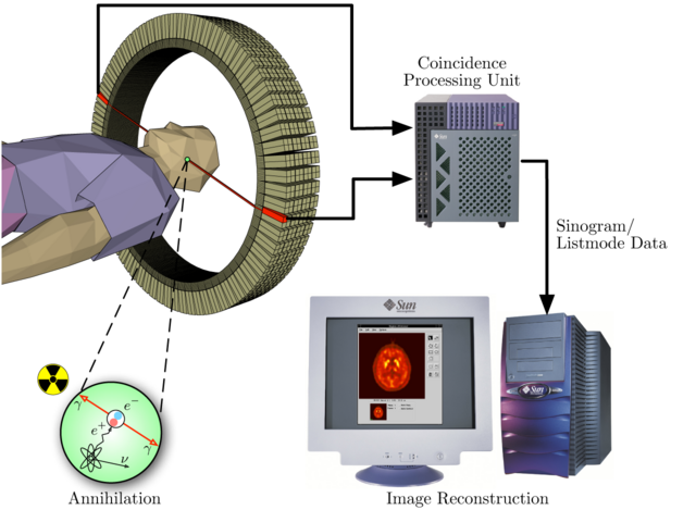 Prinzip der Aufnahme bei einer Positronen-Emissions-Tomographie (PET) 